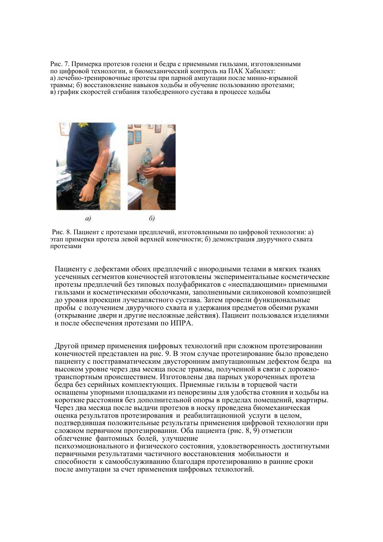 Применение аддитивных технологий при первичном протезировании конечностей — страница 8